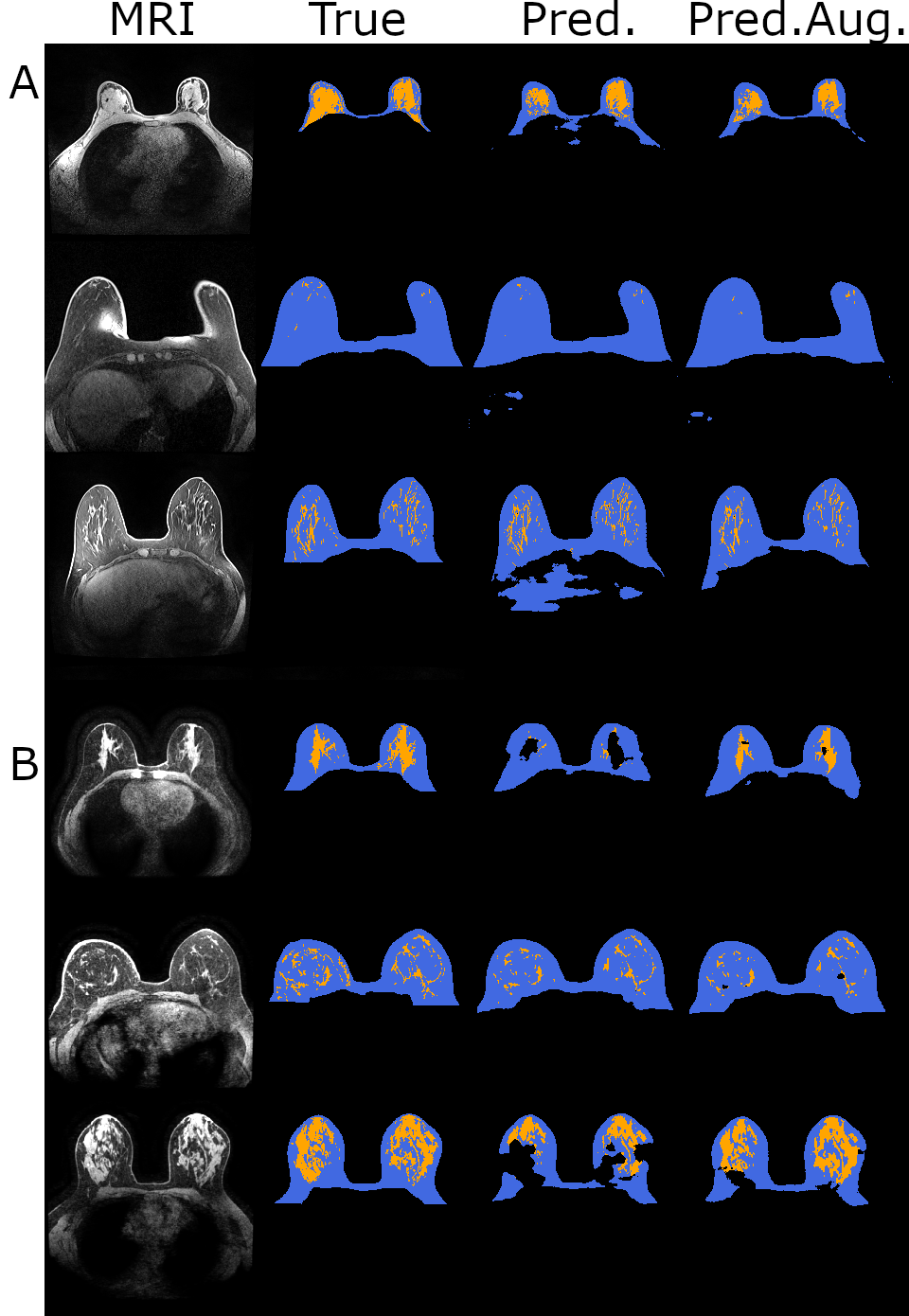 Counterfactual MRI Data Augmentation — 論文の図版