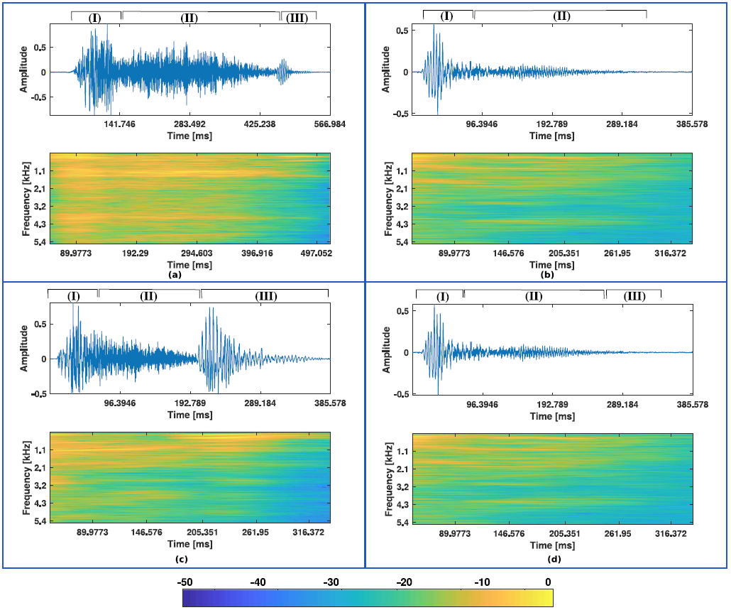 Band-Specific Cough Detection — 論文の図版