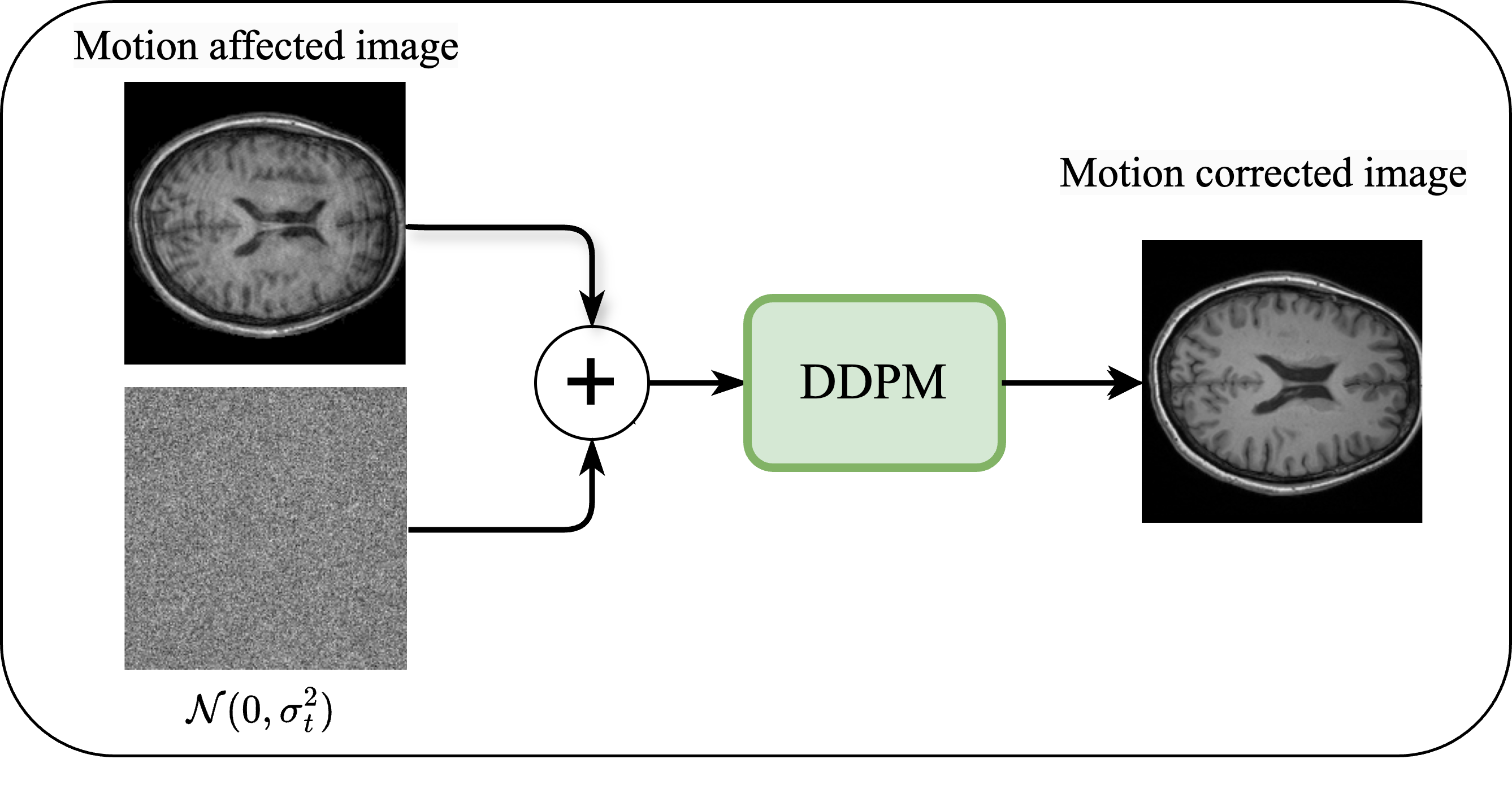 Diffusion models for brain MRI motion artifact correction — 論文の図版