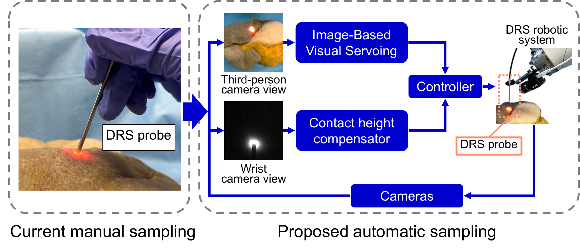 Automatic Robotic-Assisted Diffuse Reflectance Spectroscopy Scanning System — 論文の図版