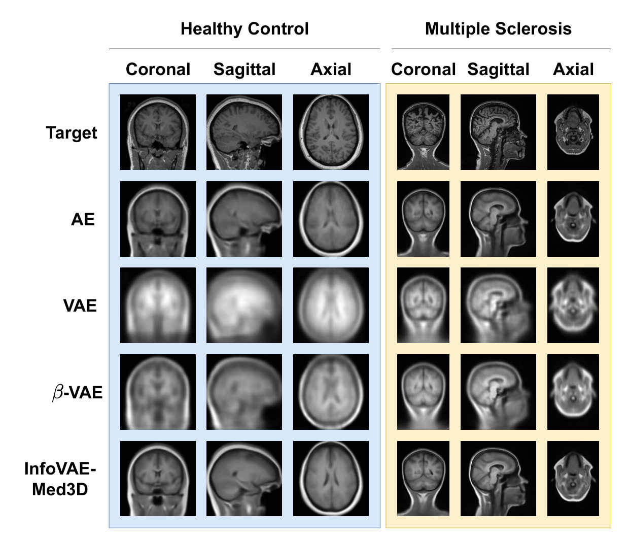InfoVAE-Med3D — 論文の図版