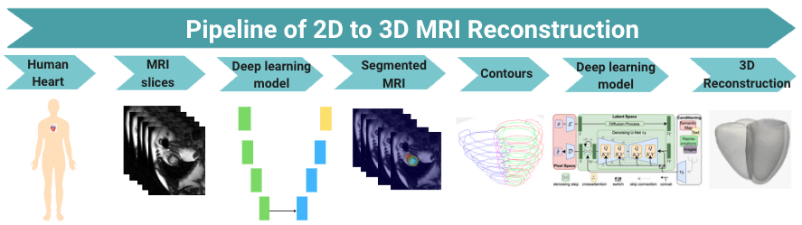 2D MRI to 3D Shape Reconstruction Review — 論文の図版