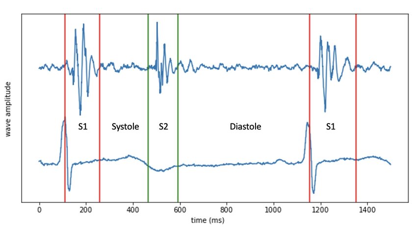CNN-H-Infinity-LSTM — 論文の図版