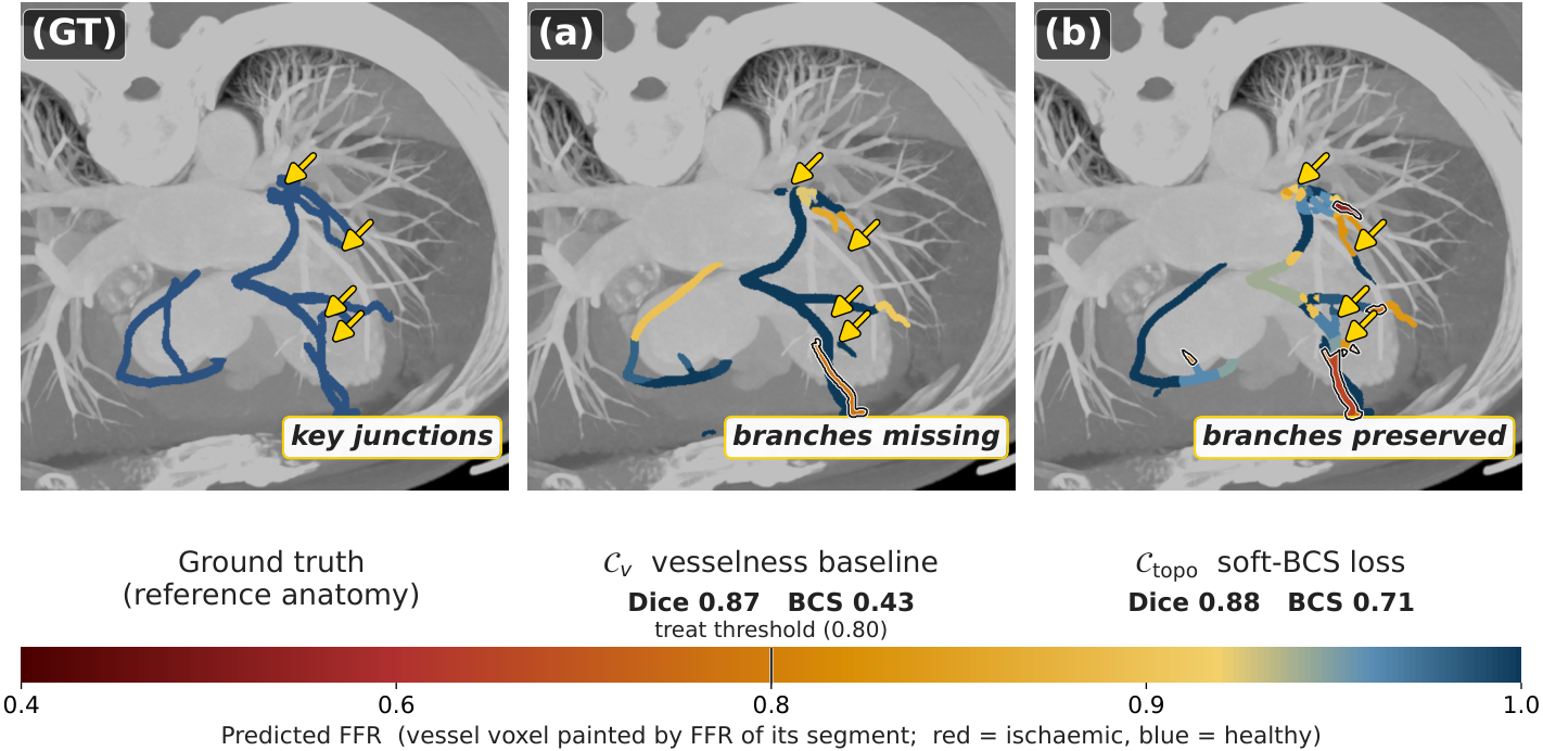 Bifurcation Connectedness Score (BCS) — 論文の図版